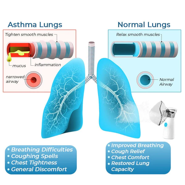 GFOUK LungDetox Nebulizer Cleansing Spray