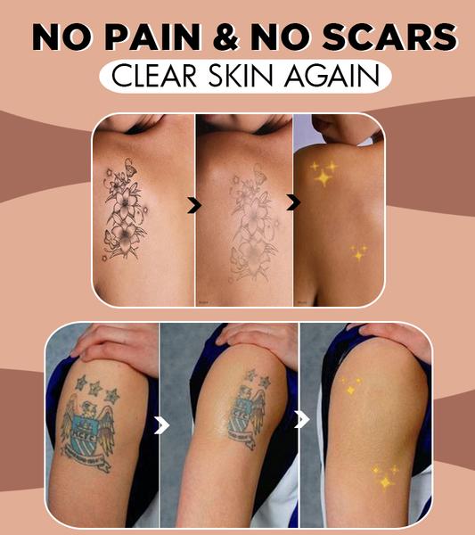 No Regret Tattoo Remove Oil