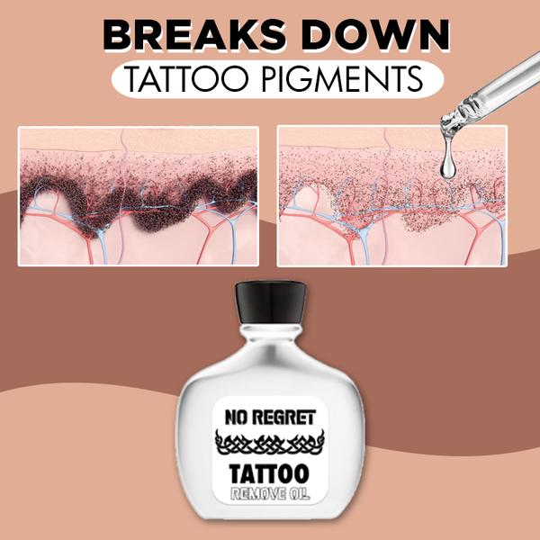 No Regret Tattoo Remove Oil