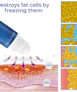 Nagasaki DermoFreeze Precise CoolSculpting Gel