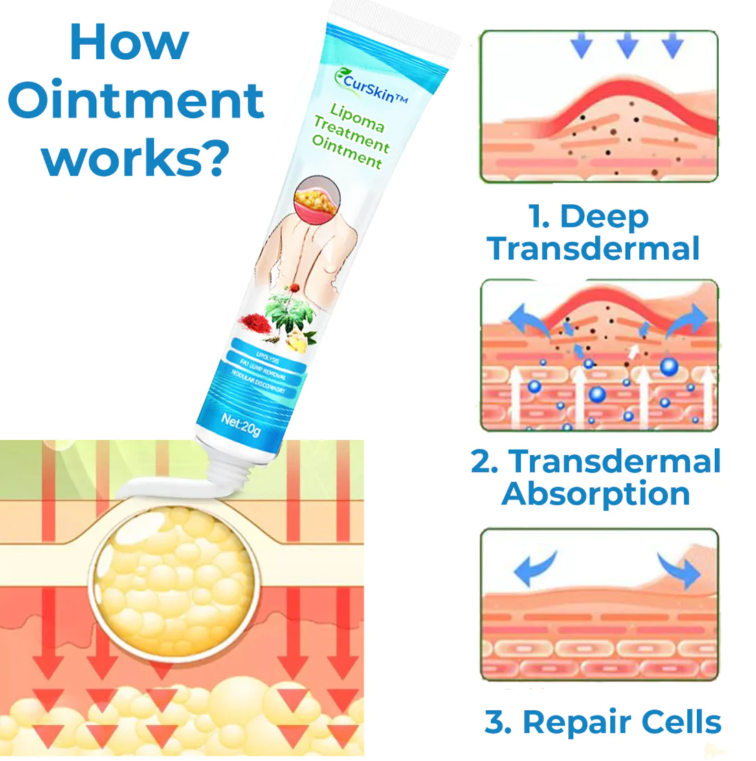 CurSkin Lipoma Treatment Ointment