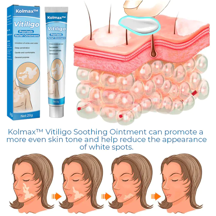 Kolmax Vitiligo Soothing Ointment