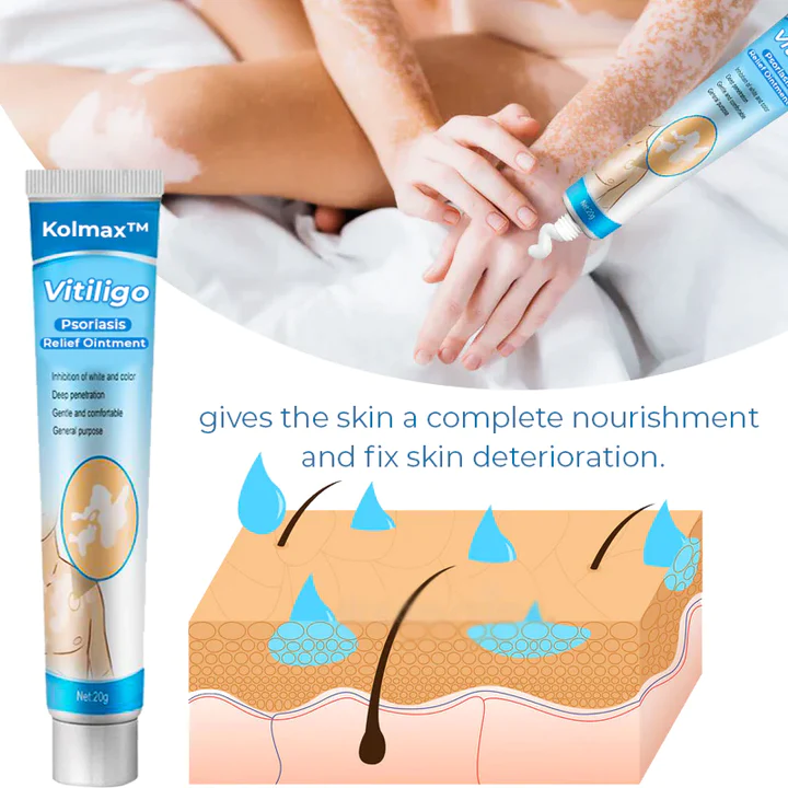 Kolmax Vitiligo Soothing Ointment