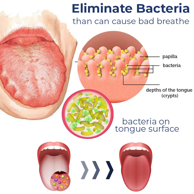 Canada Bioluma White Hairy Tongue Removal Kit