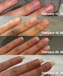 GFOUK 7 Days Nail Growth and Strengthening Serum