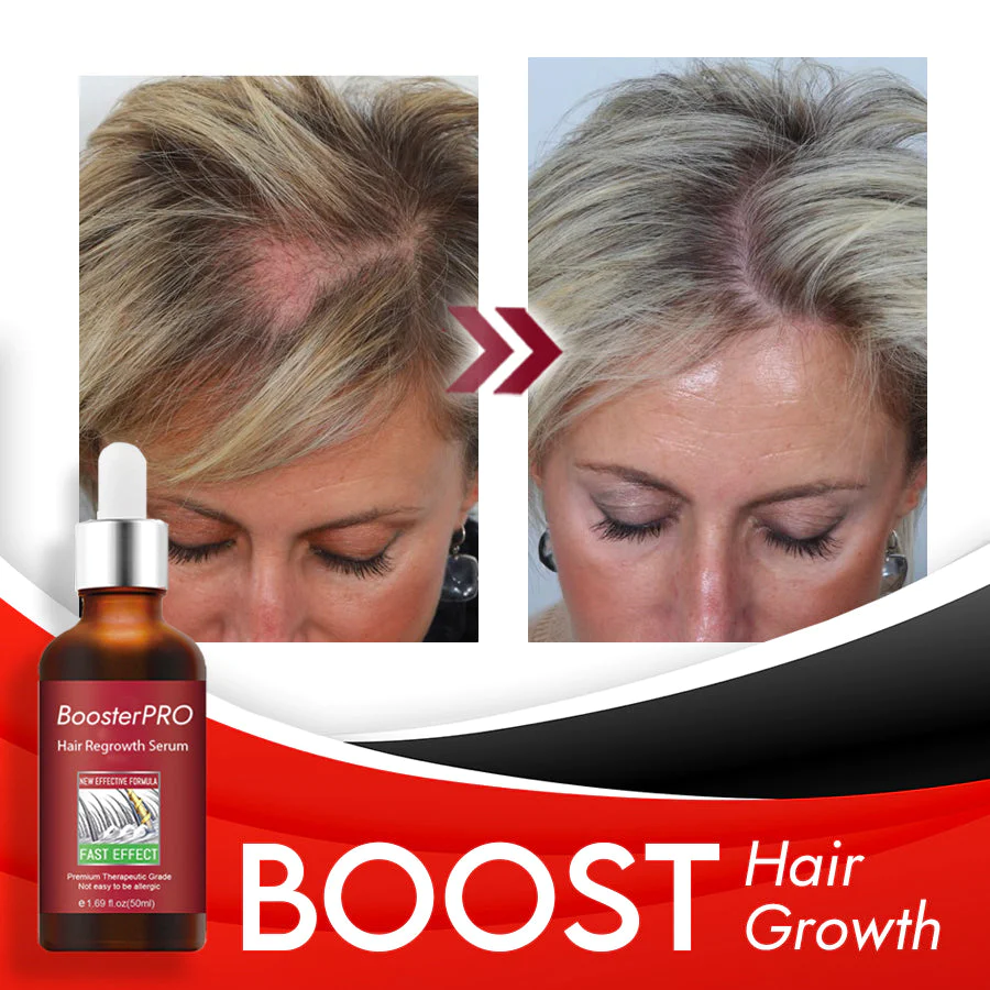 BoosterPRO Hair Regrowth Serum