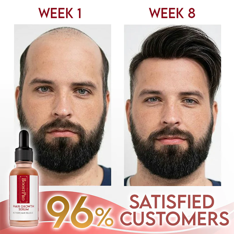 BoostPRO Hair Growing Serum