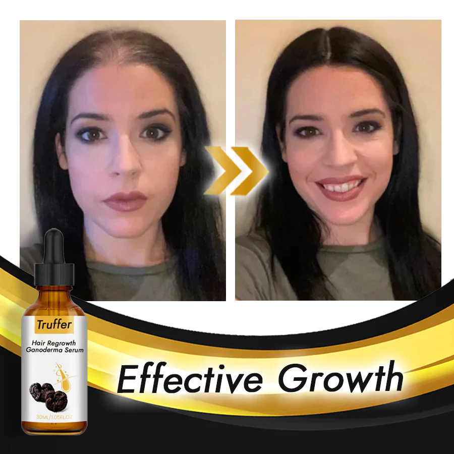 Truffer Hair Regrowth Ganoderma Serum