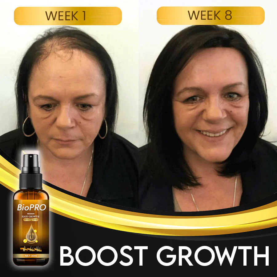 BioPRO Hair Growth Boosting Spray