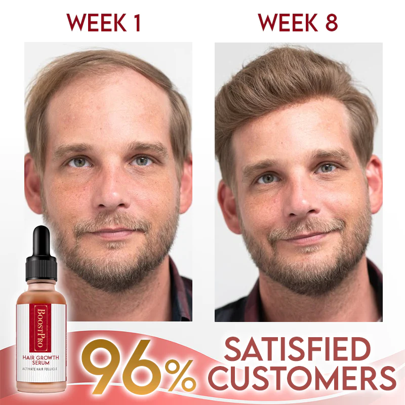 BoostPRO Hair Growing Serum