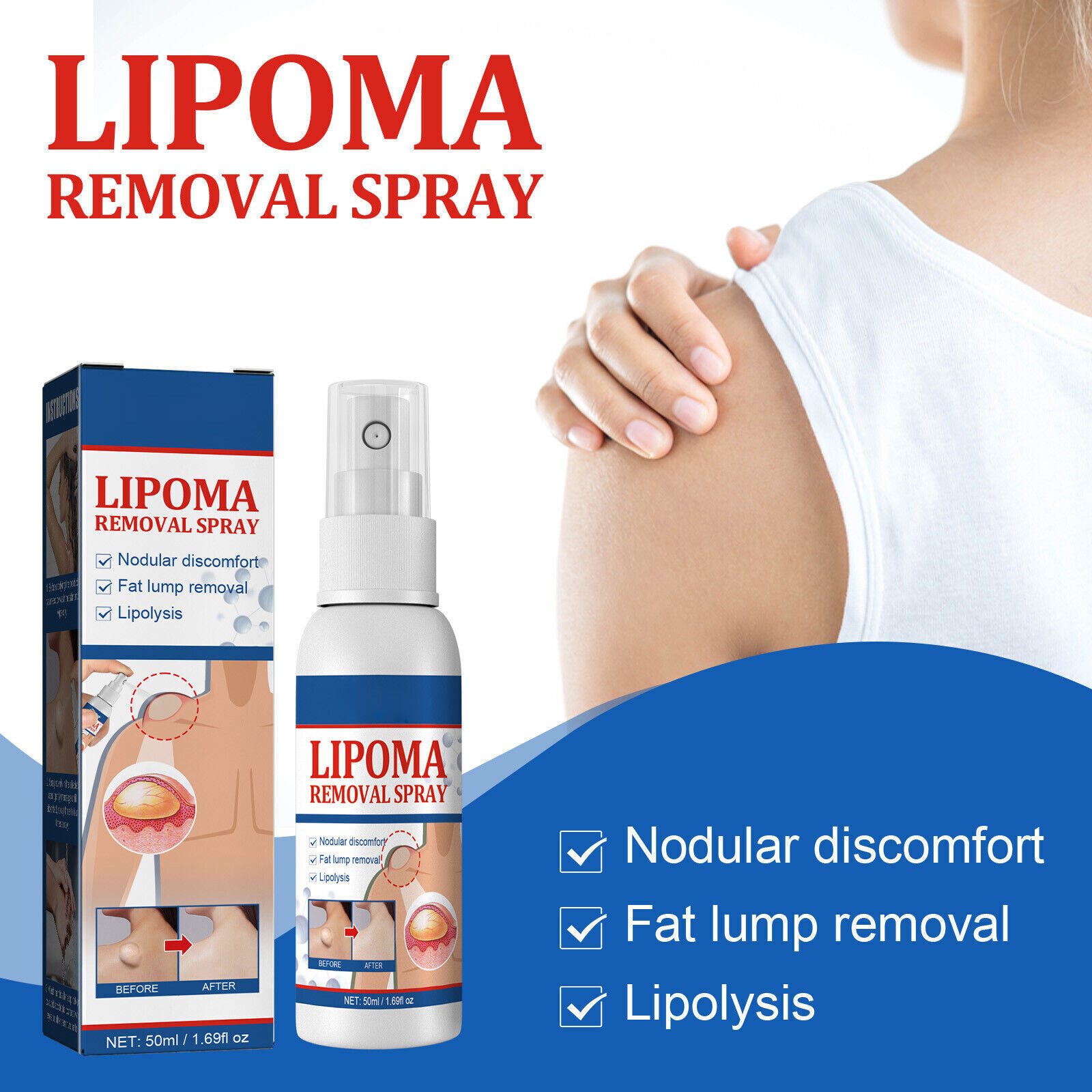 Herbal Lipoma Removal Spray