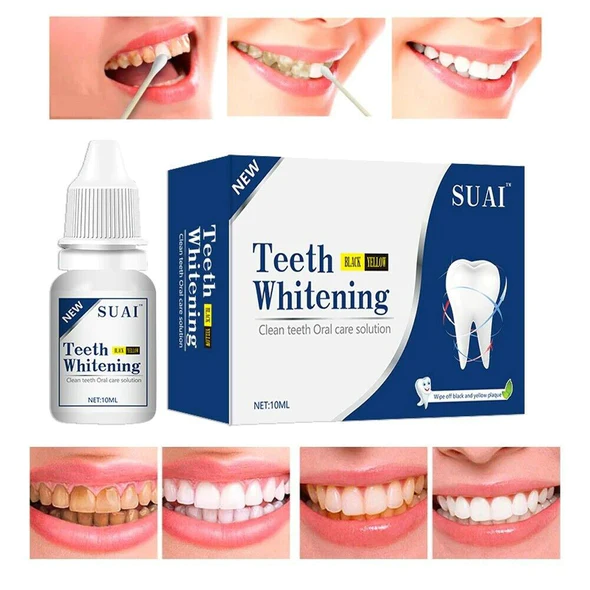 Shinyteeth Scaling agent, Calculus Removal, Teeth Whitening, Healing Mouth Ulcers, Eliminating Bad Breath, Preventing and Healing Caries, Tooth Regeneration