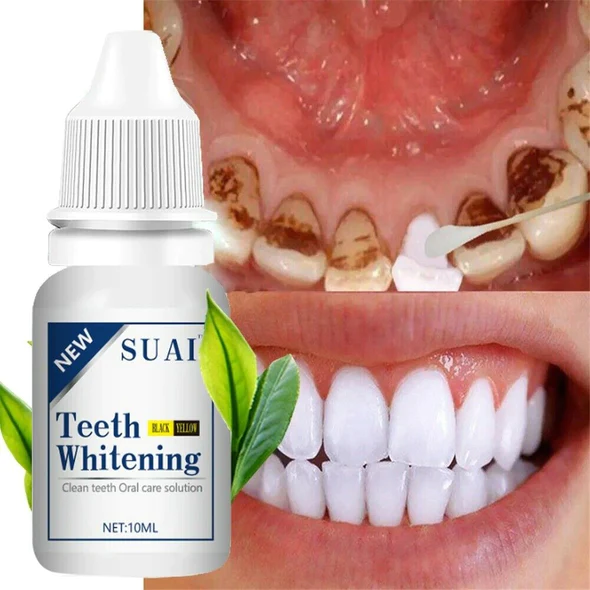 Shinyteeth Scaling agent, Calculus Removal, Teeth Whitening, Healing Mouth Ulcers, Eliminating Bad Breath, Preventing and Healing Caries, Tooth Regeneration