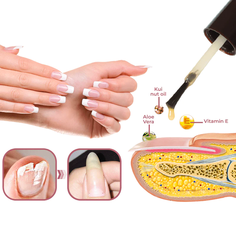 GFOUK Peeling Nail Therapy Vitamin E Serum