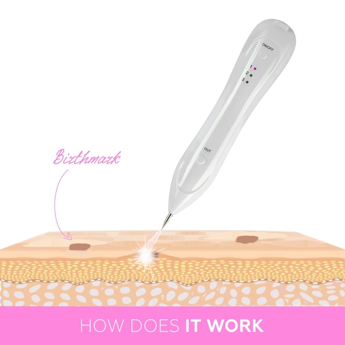 Plasma Pen Skin Tag & Mole Remover