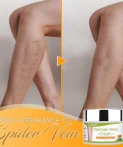 Organic Healing Cream for Varicose Vein