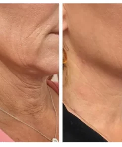 Oveallgo Collagen Firming Neck Cream