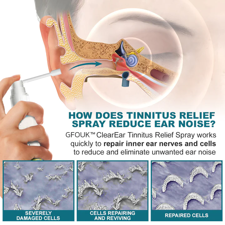 GFOUK ClearEar Tinnitus Relief Spray