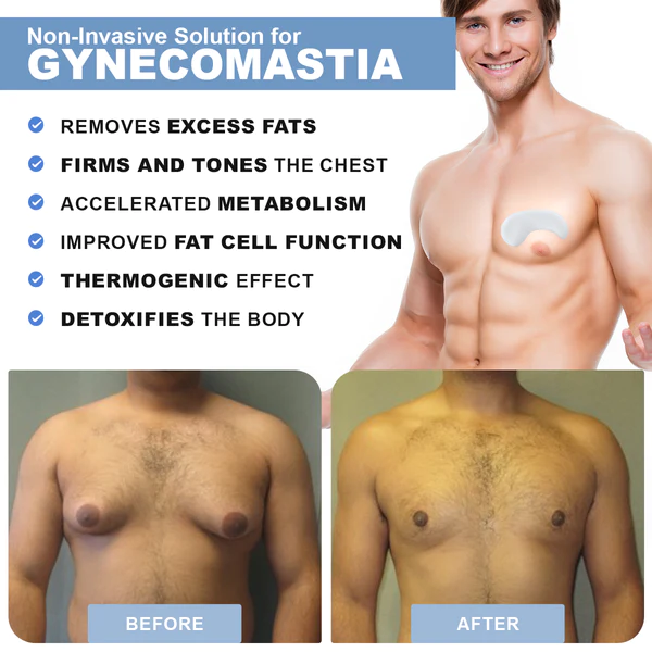 Luhaka GynoPatch  Advanced Gynecomastia Reduction Patch