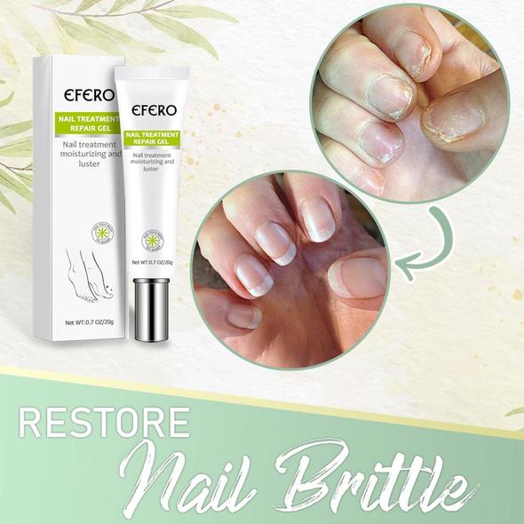 Nail Fungus Instant Treatment Gel