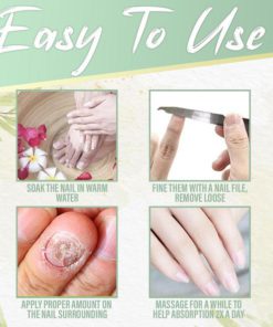 Nail Fungus Instant Treatment Gel