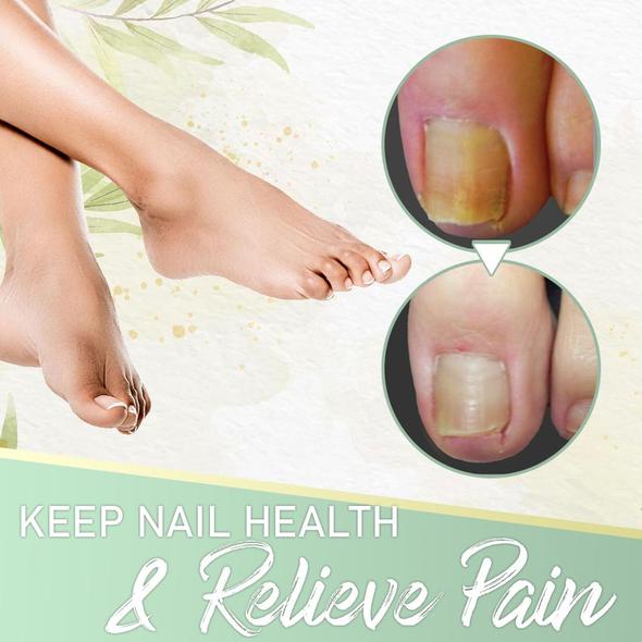 Nail Fungus Instant Treatment Gel