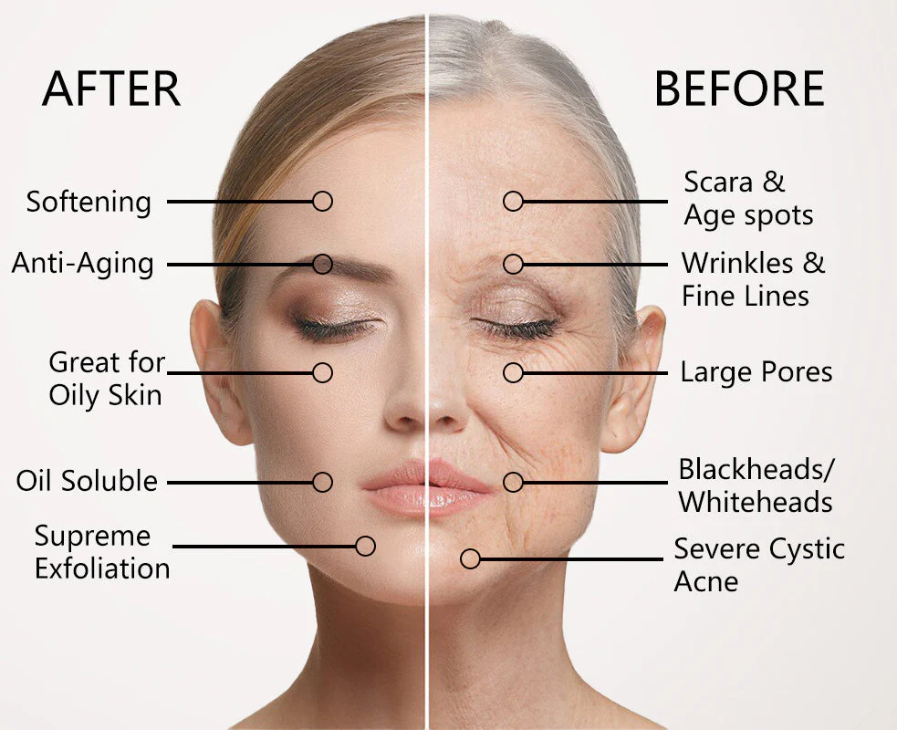 KSOM Anti-Aging & Anti-Wrinkle Serum