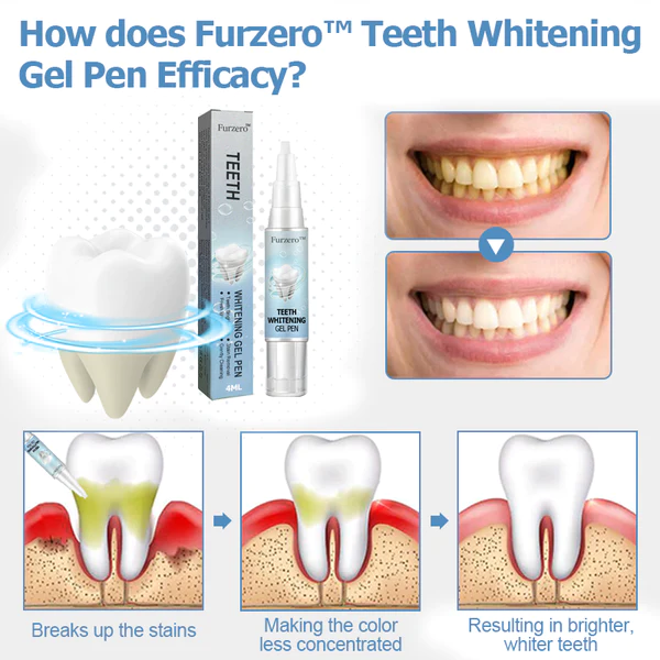 Furzero Teeth Whitening Gel Pen